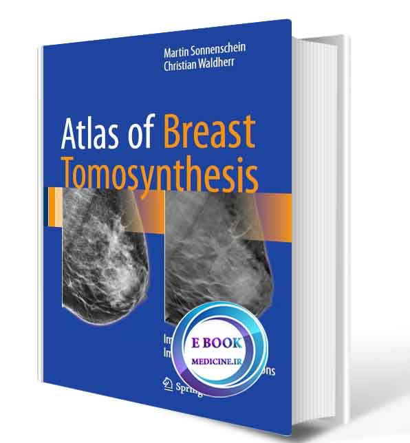 دانلود کتاب Atlas of Breast Tomosynthesis: Imaging Findings and Image-Guided Interventions2017 (ORIGINAL PDF)